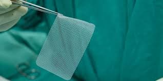Hernia Mesh Complications